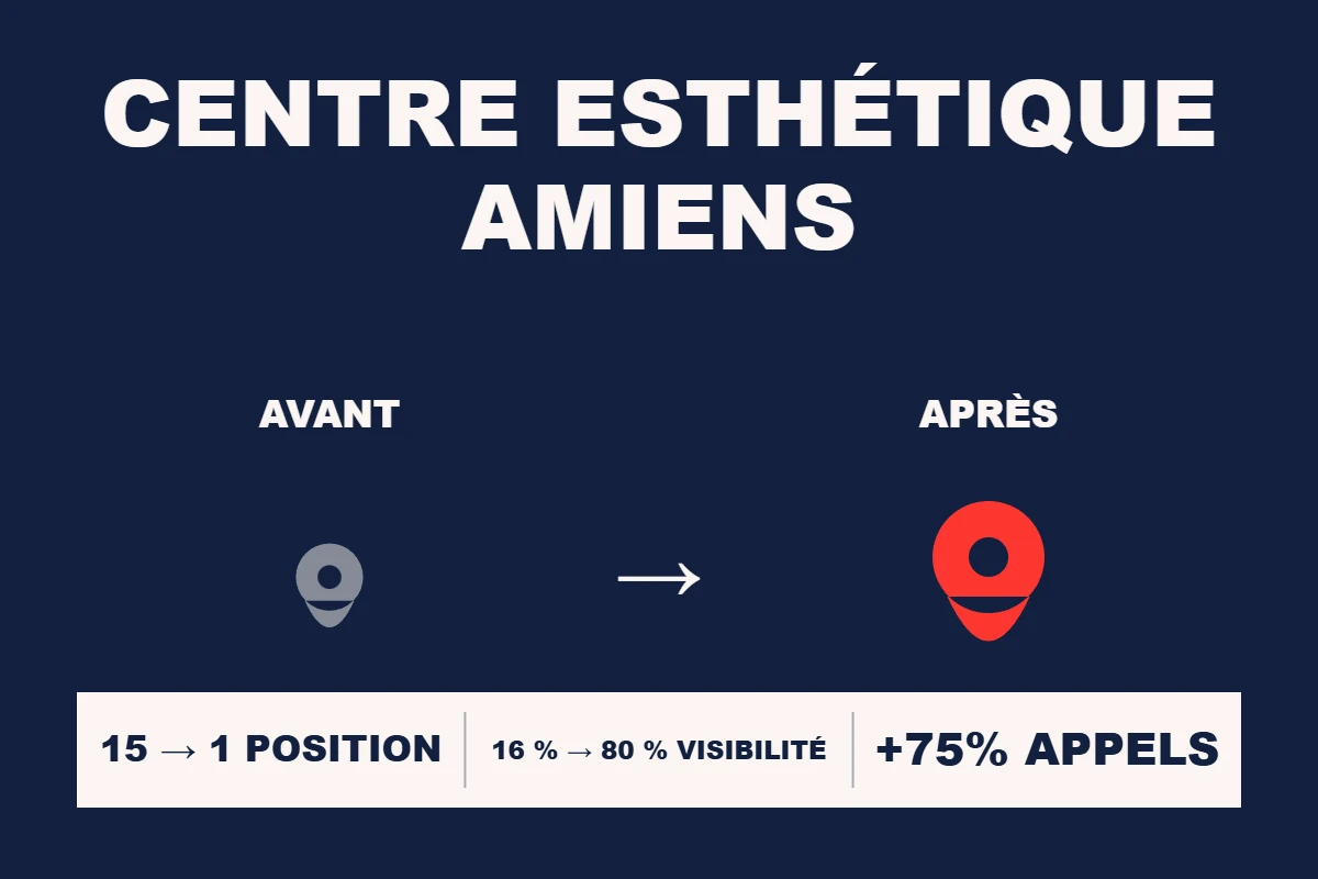 Étude de cas Resamatic — Centre esthétique Amiens