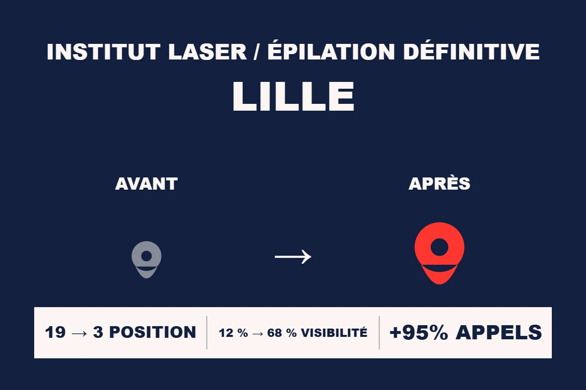 Étude de cas Resamatic — Institut laser / épilation définitive Lille